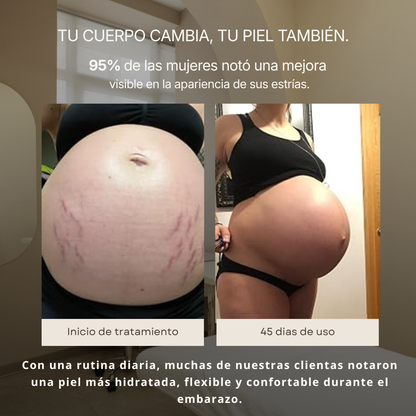 Belly & Body Oil - Aceite corporal para embarazadas