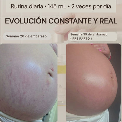 Belly & Body Oil - Aceite corporal para embarazadas
